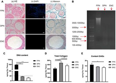 Nerve ECM and PLA-PCL based electrospun bilayer nerve conduit for nerve regeneration